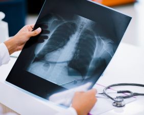 Digital X-ray
