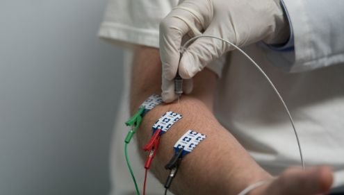 Electromyogram (EMG)