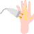 Nerve Conduction Velocity